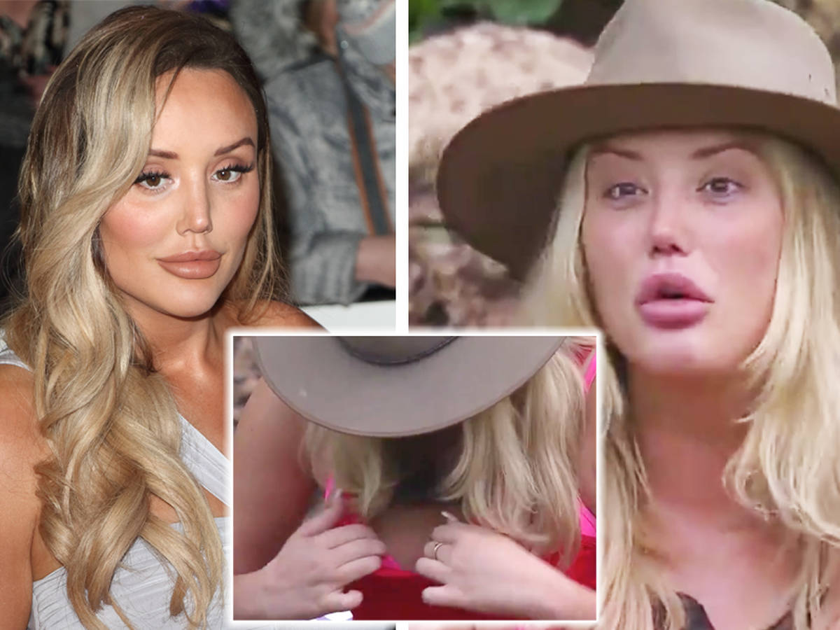 Charlotte Crosby Opens Up About 'Uniboob' That Saw Her Get Surgery On I'm A  Celeb - Capital