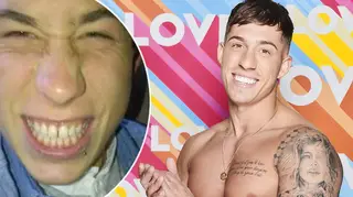 Love Island's Connor Durham is very happy with his new teeth despite criticism