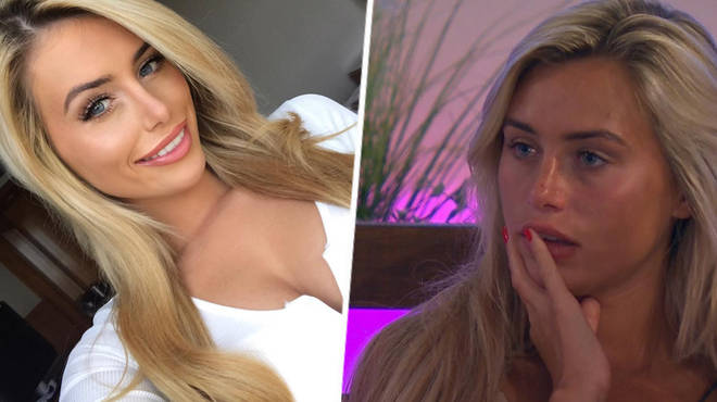 Love Island's Ellie Brown Looks Unrecognisable In Throwback 'Before Surgery' Pictures