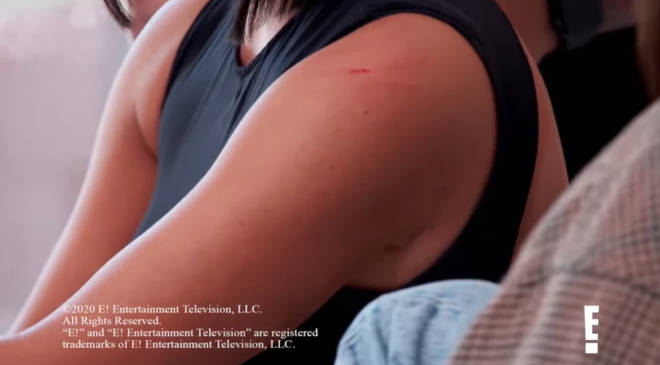 Kim Kardshian's visible scratches after her fight with Kourtney