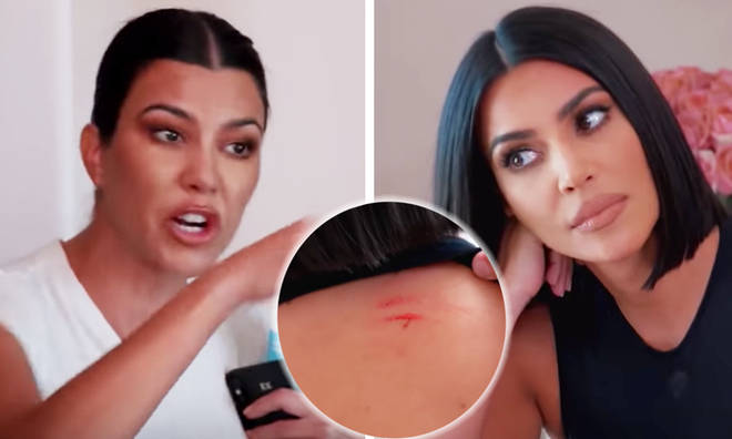 Kim Kardashian left bloodied after her fight with Kourtney