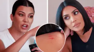 Kim Kardashian left bloodied after her fight with Kourtney