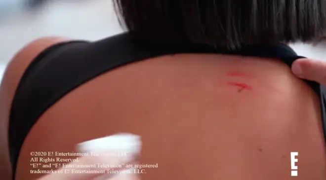 Kim Kardashian's back left scratched and bleeding