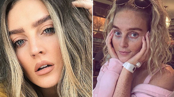 Perrie Edwards Is Recovering From Throat Surgery
