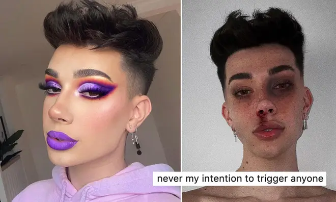 James Charles has defended taking part in the 'mugshot challenge' after backlash