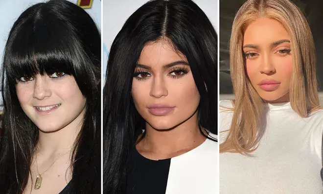 Kylie Jenner before and after: A complete transformation