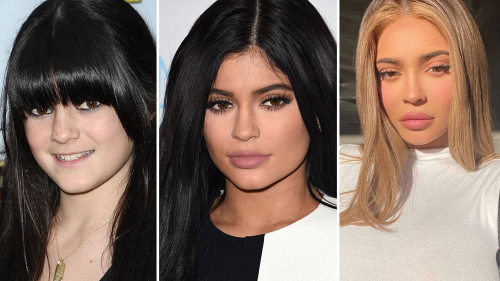 Kylie Jenner Before And After: Pictures Of Her Drastic Transformation  Revealed - Capital