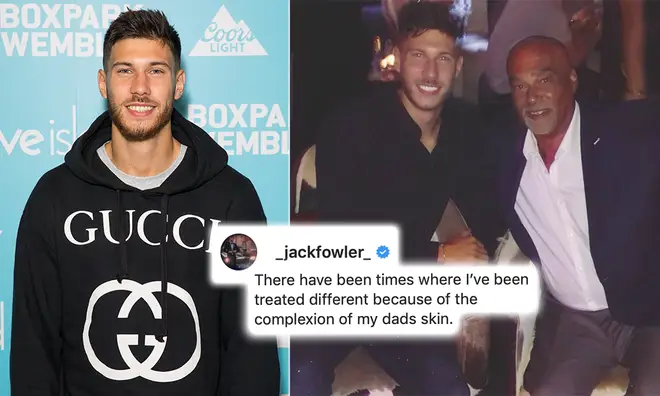 Jack Fowler said he was 'treated differently' growing up mixed race
