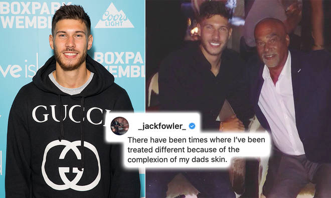 Jack Fowler said he was 'treated differently' growing up mixed race
