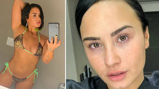 Demi Lovato has opened up about her eating disorder.