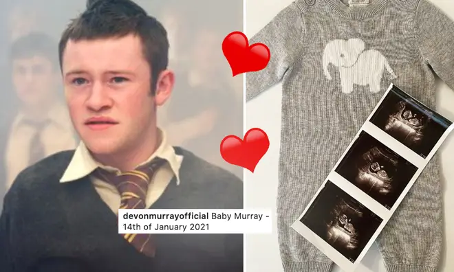 Devon Murray, who portrayed Seamus Finnigan, is going to be a dad!