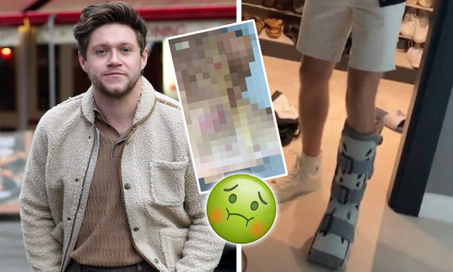 Niall Horan shows his injured foot on Instagram