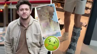 Niall Horan shows his injured foot on Instagram
