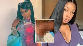 Megan Thee Stallion underwent surgery to get the bullets removed from her feet