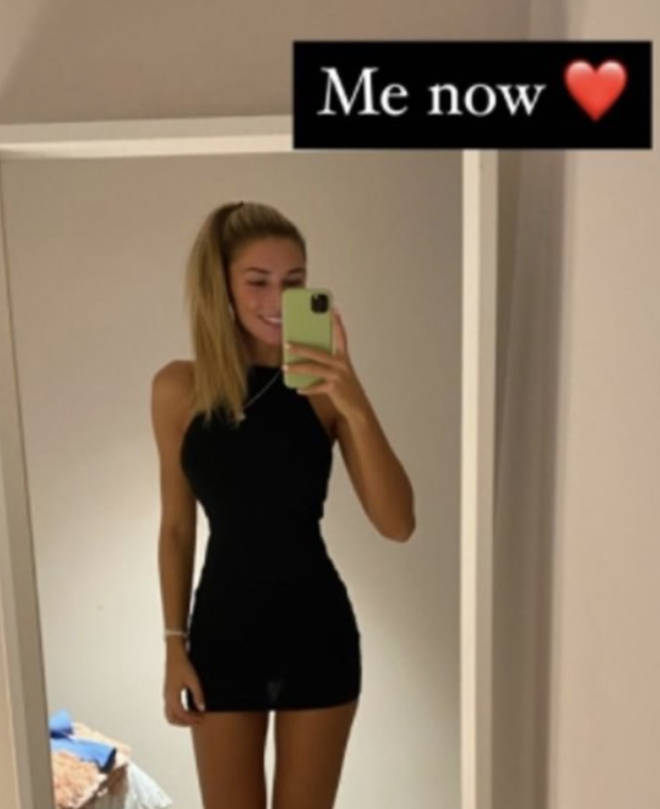 Zara McDermott shows off 'after' photos of weight loss