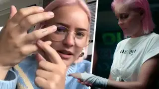 Anne-Marie broke her finger on the set of the 'Don't Play' music video