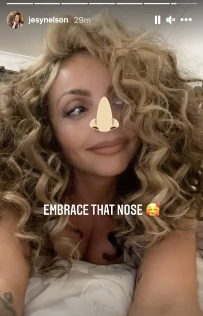 Jesy Nelson tells her followers to 'embrace that nose'