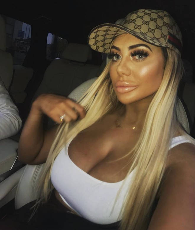 Chloe Ferry has been open about her plastic surgery, which she say trolls contributed to