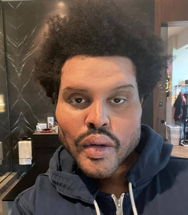 Fans are curious about whether or not The Weeknd had plastic surgery.
