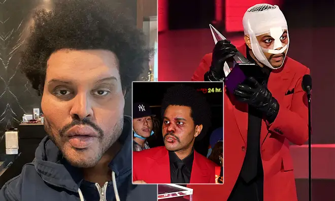 The Weeknd's bandages have left fans confused, with some speculating about whether or not he had plastic surgery.