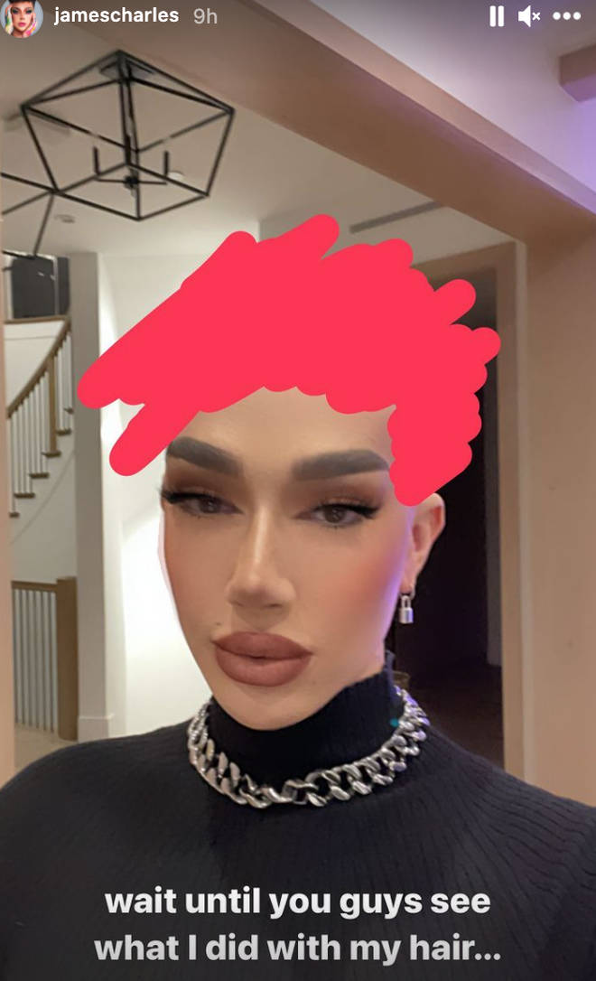 James Charles teased his bald look before the grand unveiling