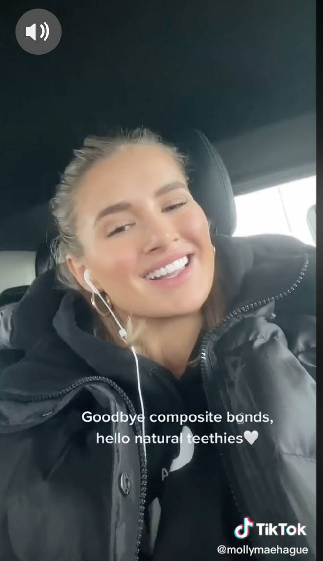 Molly-Mae Hague shared a video of her 'natural teeth' on TikTok.