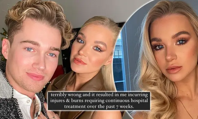 AJ Pritchard's girlfriend Abbie Quinnen suffers serious burns