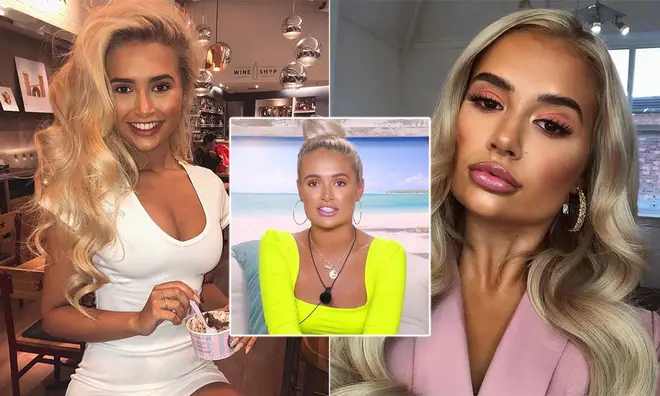 Molly-Mae Hague has had her jaw and lip fillers reversed following her cosmetic work after Love Island.