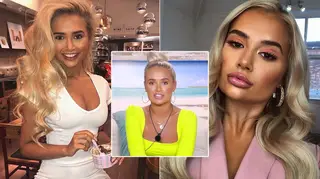 Molly-Mae Hague has had her jaw and lip fillers reversed following her cosmetic work after Love Island.