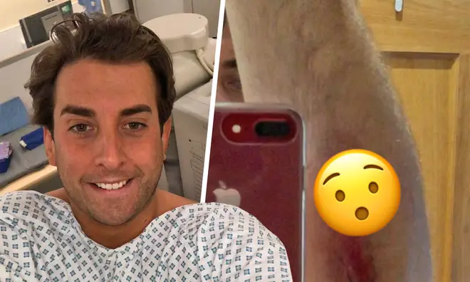 James Argent was taken to hospital after crashing his motorbike for a second time
