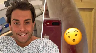 James Argent was taken to hospital after crashing his motorbike for a second time