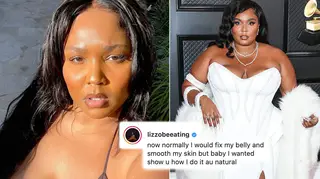 Lizzo has shared a body-positive post for fans as she posted a completely unedited photo.