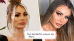 TOWIE star Chloe Sims removes fillers after years