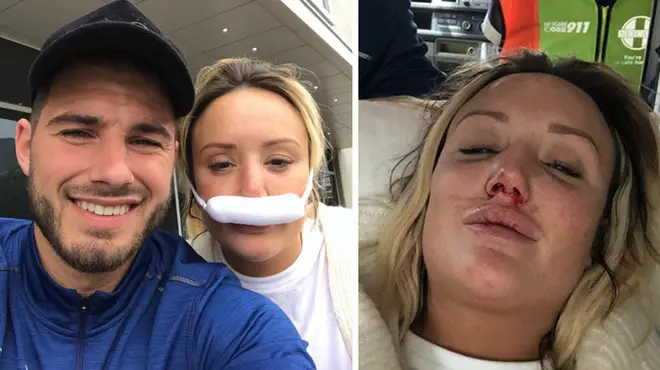 Charlotte Crosby broke her nose in three places during filming.