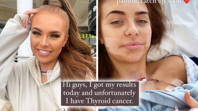 Demi Jones has been diagnosed with thyroid cancer