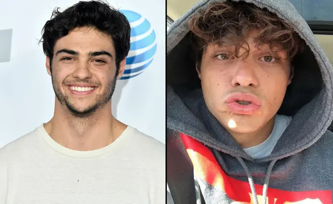 Noah Centineo attends iHeartRadio's KIIS FM Wango Tango by AT&T at Banc of California Stadium on June 2, 2018 in Los Angeles, California/duck lips selfie