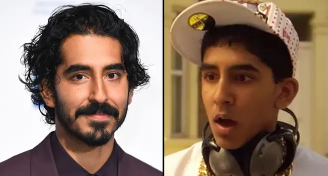 Dev Patel says being called the "ugliest" Skins character affected his self-esteem