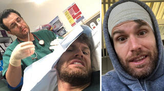 Joel Dommett had to get stitches for his head injury.