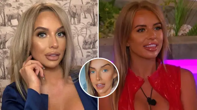 Faye Winter showed fans what her natural lips looked like after having her filler dissolved