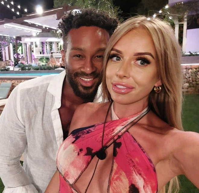 Faye Winter said she was left with uneven lips after a Love Island challenge