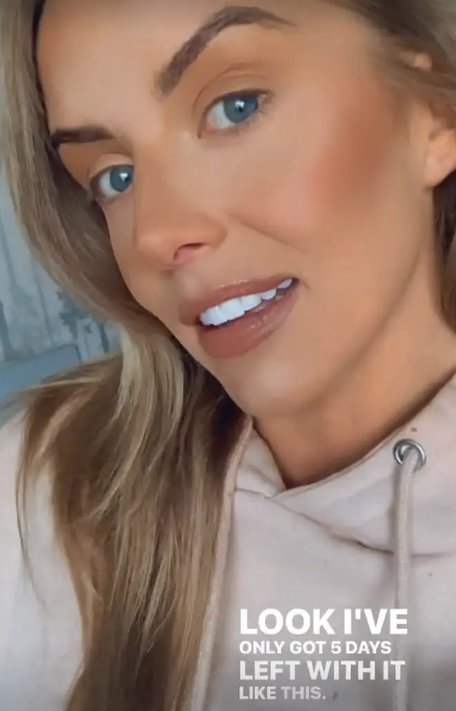 Faye from Love Island got her lip filler dissolved earlier this month