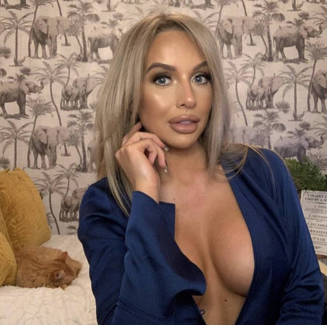 Faye Winter revealed a Love Island challenge left her lips uneven
