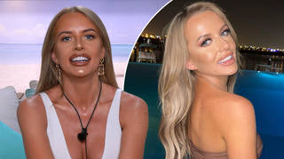 Love Island's Faye Winter showed before and after photos amid dissolving her lip filler