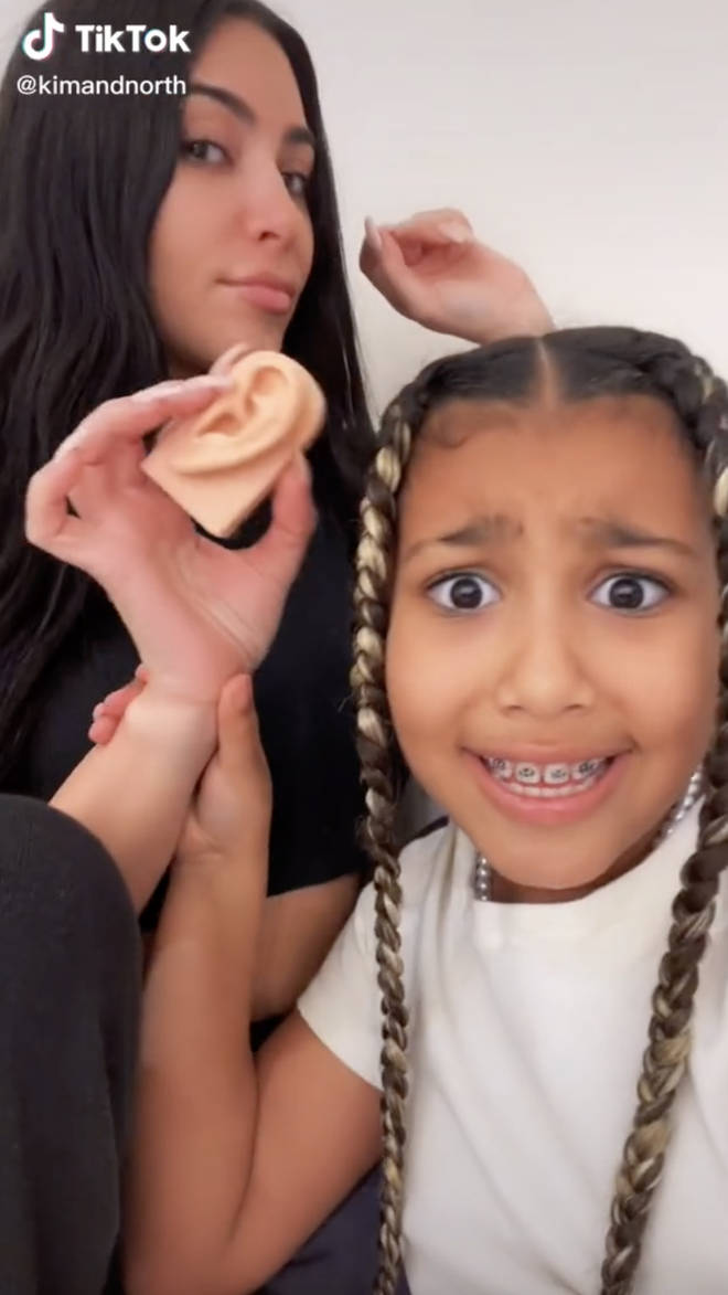 Fans are divided over North West's braces