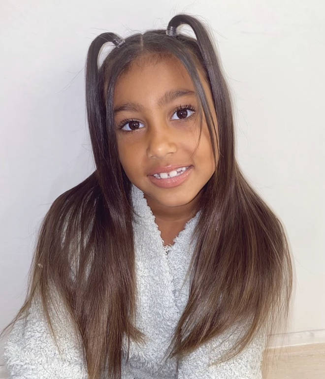 Some fans were concerned over whether North West is too young for braces