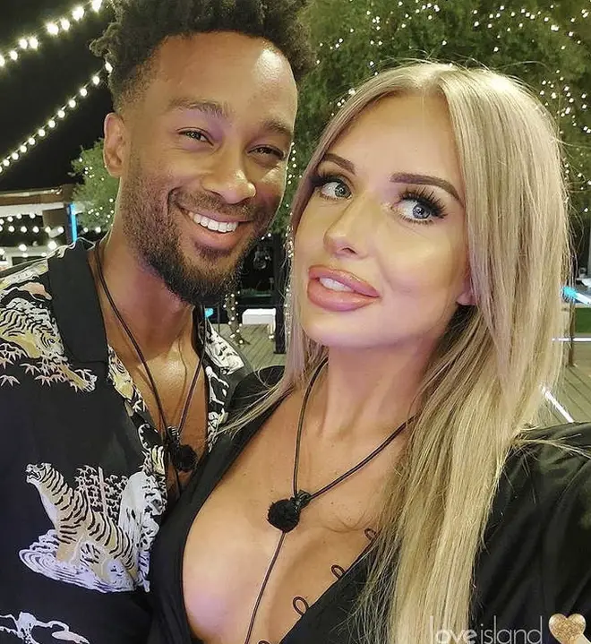 Faye previously revealed that a Love Island challenge left her fillers unevenFaye previously revealed that a Love Island challenge left her fillers uneven