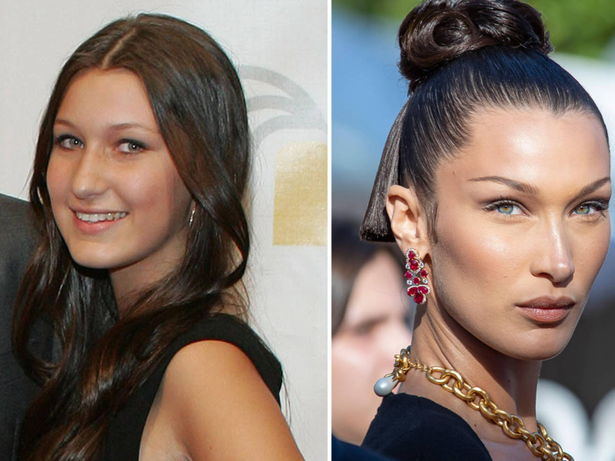 Bella Hadid Fans Question Why She Was Allowed Surgery At 14 - Capital