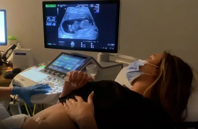 Charlotte Crosby captured her first baby scan