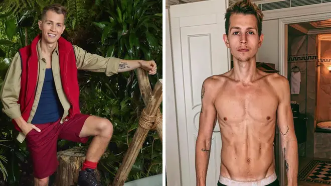 James McVey admits his 'negative relationship' with food after I'm A Celeb