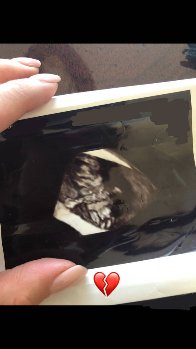 Shay Mitchell shared a snap of her ultrasound scan